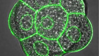 Einzelne embyonale Zellen werden durch ihre Zellmembranen (grün) dargestellt. Der kleine innere Kreis zeigt die Kernlamelle, in dem sich das Genom befestigt. (Helmholtz Zentrum München)