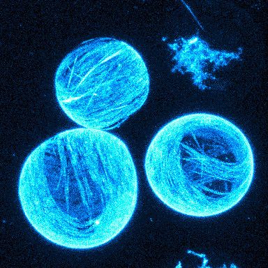 Künstliches Minimalmodell für Zellverformungen. Die eingeschlossenen Biomoleküle bilden eine aktive Schicht an der Membran, die eine fortwährende Bewegung antreibt. (Bild: Keber, Loiseau, Sanchez, Bausch/TUM)