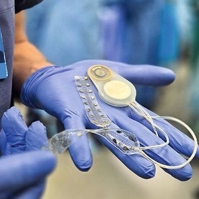 Dr. Martin Schuettler mit dem Brain Interchange System (Bild: Cortec)