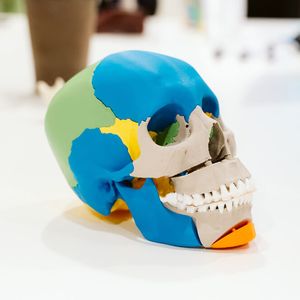 Modell für die Schädelchirurgie aus dem 3D-Lab des Radboud UMC Nimwegen.(Bild:  Merel Tuk/Deltagoud)