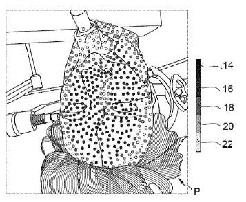 Medizinisches System sowie Verfahren zur Überprüfung einer Registrierungsgenauigkeit(Bild:  B. Braun New Ventures GmbH/DPMA)