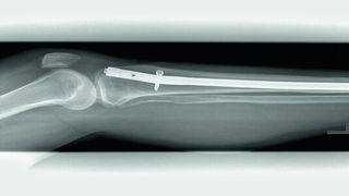 SMT entwickelt in Zusammenarbeit mit und für Kunden und Operateuren Instrumente, Implantate, Apparate und Sets für die Human- und Veterinärmedizin. (Bild: SMT)