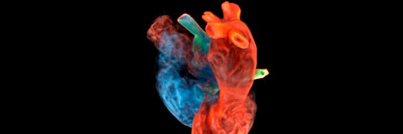 Der digitale Herzzwilling von Siemens Healthineers.