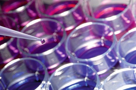 Zellbasierter Assay zur Identifizierung von Immunmodulatoren. Zellbasierter Assay zur Identifizierung von Immunmodulatoren.