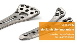 case-study-vogel-online-firmenprofil-radiusplatte (Heraeus AMLOY Technologies GmbH)
