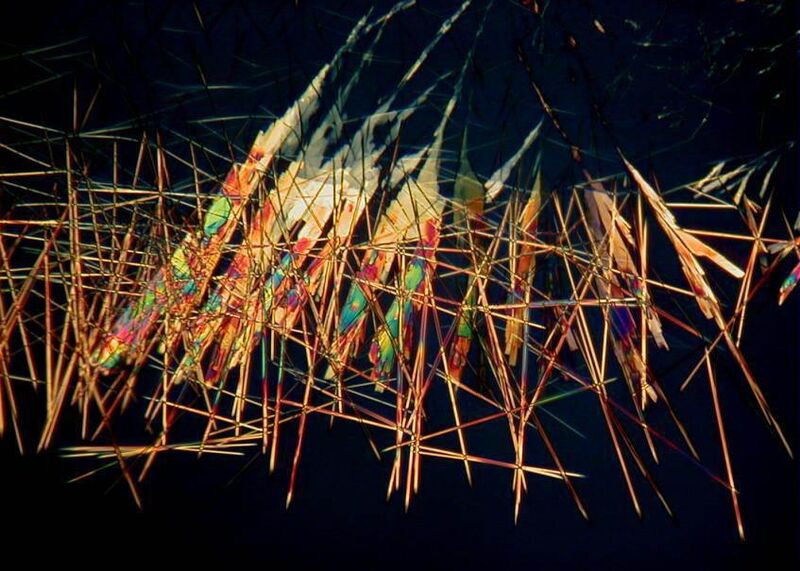 Wie bunte Mikado-Stäbchen erscheinen die Strukturen einer Ananas. Mehr faszinierende Aufnahmen von Früchten unter dem Polarisationsmikroskop finden Sie hier. 
Quelle: http://www.unleashed-visions.com  (Ludwig Eckl)