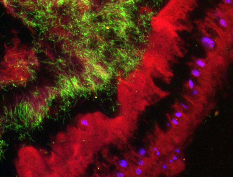 Die Fluoreszenz-in-situ-Hybridisierung der symbiotischen Mikroorganismen im Darm der Insekten zeigt allgemeine Bakterien (rot), Coriobacterium (grün) und die Zellkerne des Wirtes (lila). (Bild: Sailendharan Sudakaran / Max-Planck-Institut für chemische Ökologie)