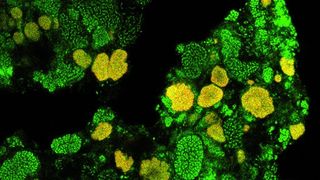1		Nachweis der Mikrokolonien von Nitrospira (gelb) sowie anderer Bakterien (grün) in Klärschlamm mittels Fluoreszenz-in-situ-Hybridisierung (Bilder: Universität Wien, Department für mikrobielle Ökologie). (Archiv: Vogel Business Media)