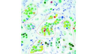 Das CRi Nuance ein Systemermöglicht in der Hellfeldmikroskopie spezifische vierfach- und fünffach-Färbungen plus Counterstain.  (Bild: L.O.T.-Oriel)