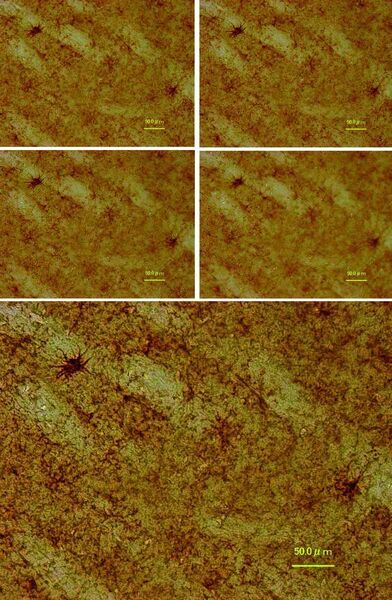 2	 Mittels Vollfokussierung werden vier unscharf aufgezeichnete Bilder von Gliazellen (links) zu einem vollfokussierten, hochpräzisen und scharfem Bild (rechts) zusammengefügt. Bild: Keyence (Archiv: Vogel Business Media)