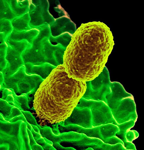 Antibiotika-resistente Bakterien der Art Klebsiella pneumoniae (gelb) unter dem Elektronenmikroskop.  (Bild: National Institute of Allergy and Infectious Diseases (NIAID))