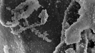 Beläge aus zersetztem Elektrolyt auf Graphitpartikeln der Anode eines NMC-Lithiumionen-Akkus, der mit hoher Ladespannung (4,6 V) geladen wurde. (Bild: Irmgard Buchberger / TUM)