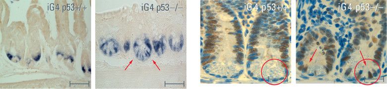 Abb.1 : Die instabilen Stammzellen des Darm werden in alternden Gewebe nicht entfernt und tragen zu einer schnelleren Gewebealterung bei: Immunhistochemische Färbung zur Identifizierung der intestinalen Stammzellen, im alternden Gewebe mit intakten p53 werden die Stammzellen deletiert (links) während diese im Gewebe mit deletierten p53 Protein erhalten bleiben (rechts, roter Kreis). (Bild: Leica)