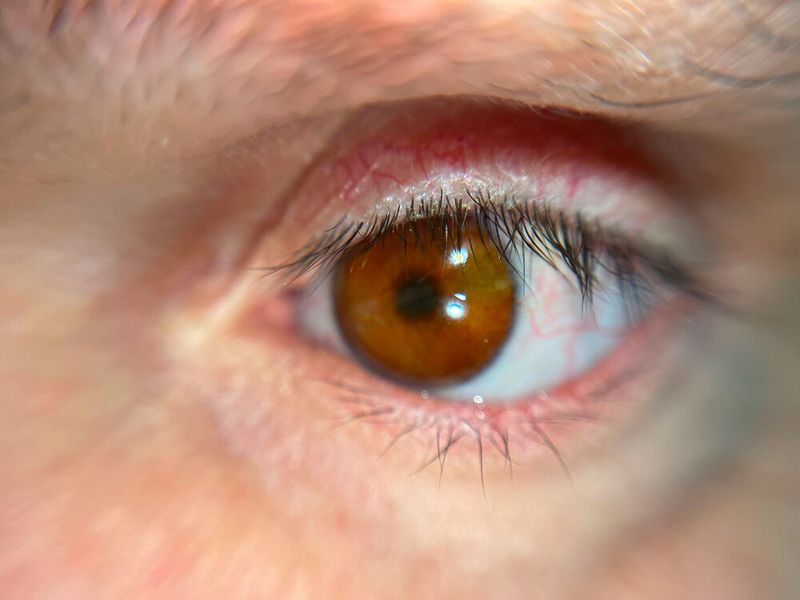 Nahaufnahme der 3D-gedruckten Augenprothese (Bild: Professor Mandeep Sagoo)