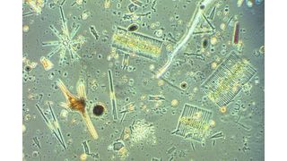 Blick durchs Mikroskop auf die vielfältige Mikroalgengemeinschaft eines Sees – zu sehen sind verschiedene Kieselalgen (Diatomeen), Grünalgen und Panzergeißeltierchen (Dinoflagellaten). (Bild: Maria Stockenreiter /LMU München)