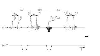 Gleichzeitige MRT-Mehrschichtmessung. (DPMA)