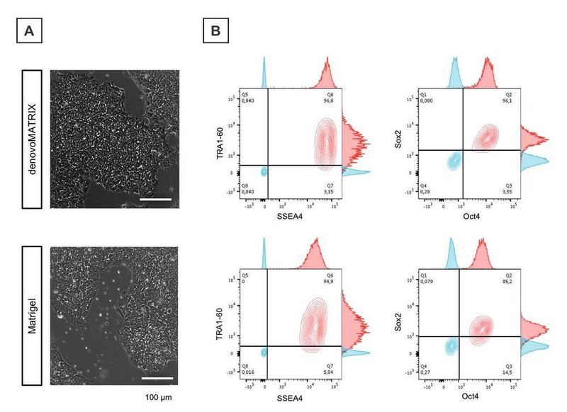 Abb.3: Erhalt des Stammzellmarker-Profils bei induzierten pluripotenten Stammzellen (iPSCs). (A) Lichtmikroskopische Aufnahme von iPSCs, oben: kultiviert auf Oberflächen der Denovo-Matrix (DM), unten: Vergleich zu Matrigel. Maßstab 100 µm. (B) Der Vergleich der Expressionsprofile der Stammzellmarker SSEA4 und Oct4 während der Kultur der iPSCs auf DM (oben) vs. Matrigel-beschichtenen Oberflächen zeigt, dass iPSCs auf den DM-Oberflächen ihren Stammzellcharakter behalten. (TU Dresden)