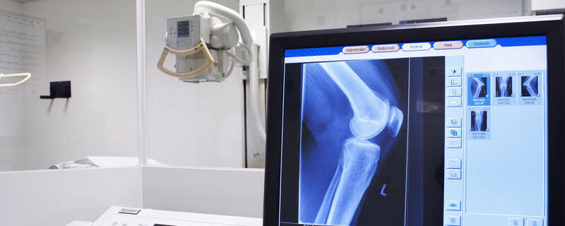 Eine TÜV-Prüfung umfasst verschiedene Sicherheitsaspekte an Röntgengeräten und je nach Geräteart gibt es bis zu 80 Prüfpunkte.