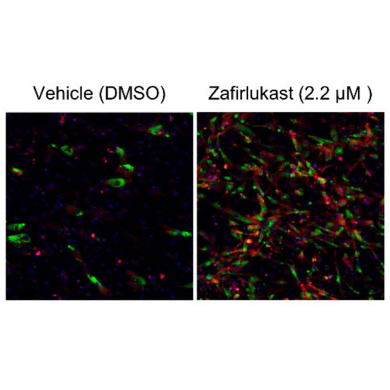 Zafirlukast induces the production of brown adipocyte tissue. For preadipocytes treated with zafirlukast (right image), brown adipocytes (shown in red) were much more prevalent than preadipocytes grown with the DMSO control (left image).