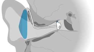 Sensor im Ohr misst Termperatur und Puls. (TU München) (Archiv: Vogel Business Media)