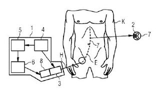 Verfahren und Vorrichtung zur Steuerung der Bewegung eines länglichen medizinischen Instruments innerhalb eines Körpers (Bild: Siemens Healthineers/DPMA)