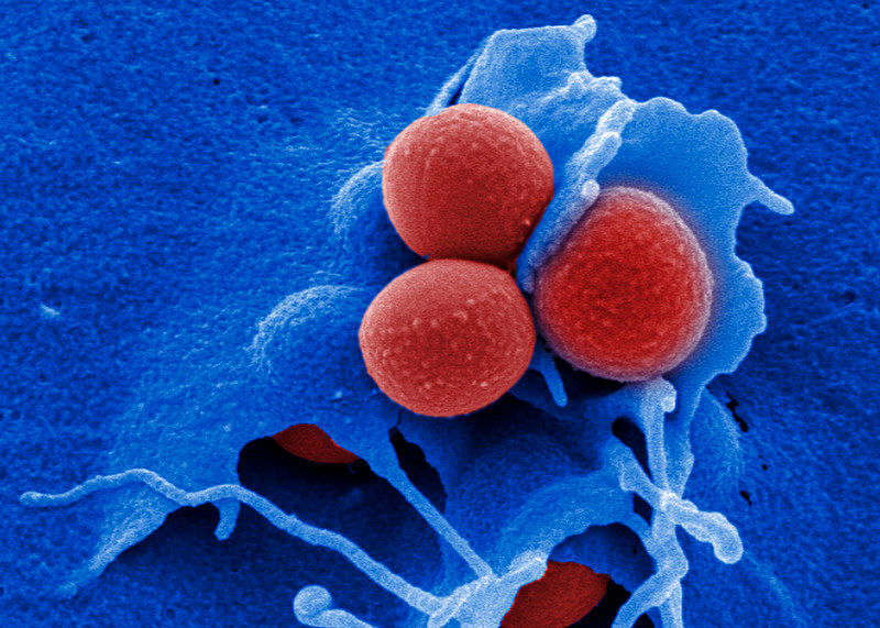Invasion von multiresistenten MRSA Staphylococcus aureus in HEP-2 Epithelzelle (HZI)