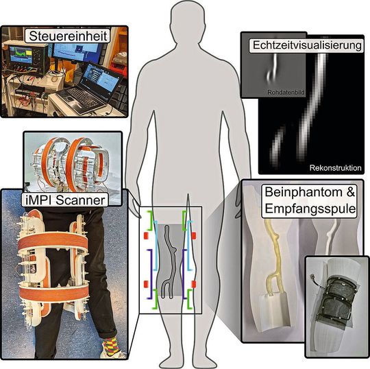 Der iMPI-Scanner ist so klein und leicht, dass man ihn fast überall mitnehmen und einsetzen kann. Das ist ein erster wichtiger Schritt hin zu einer strahlenfreien Intervention. (Bild:  Patrick Vogel / Stefan Herz)