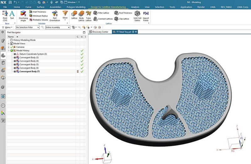 NX AM löste einige Probleme, die bei der Entwicklung der Knie-Totalendoprothese für Schwierigkeiten sorgten – zum Beispiel können die meisten Merkmale der Tibiaplatte jetzt parametrisch und damit assoziativ bearbeitet werden.  (Bild: Siemens)