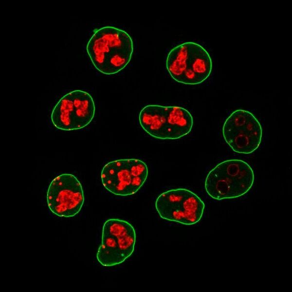 Secondary nanobodies coupled to fluorescent dyes can replace respective secondary antibodies in microscopy. The image shows cancer cells stained with primary antibodies against lamin A/C (highlighted in green) and the cell proliferation marker Ki-67 (red) that were detected with specific secondary nanobodies.  (MPI for Biophysical Chemistry/ T. Pleiner)