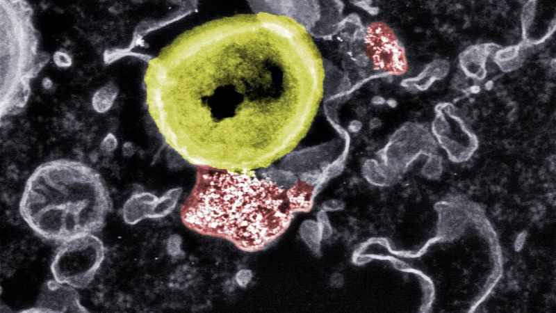 Tödlicher Kontakt: Forscher der Empa und der ETH Zürich haben Nanopartikel (rot) entwickelt, die resistente Bakterien (gelb) abtöten können. (Bild: nachkolorierte elektronenmikroskopische Aufnahme, Empa)