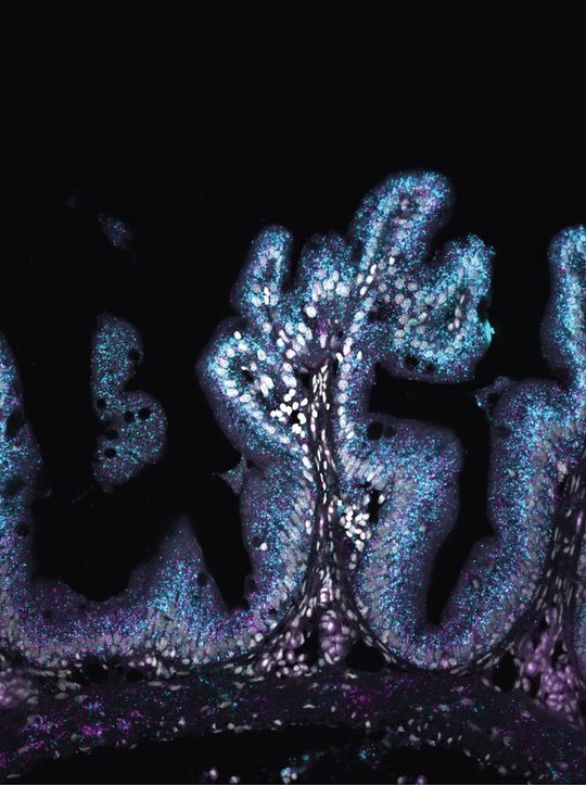 Querschnitt durch Darmfalten im Vorderdarm von Neolamprologus brevis. Angefärbt sind zwei Gene, die besonders im Darm räuberischer Arten eine Rolle spielen. Türkis zeigt Aktivität eines Gens für die Verarbeitung von Eiweissen, Violett diejenige für ein Gen im Kontext des Energiestoffwechsels.(Bild:  Patrick Tschopp, Universität Basel)