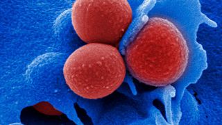Invasion von multiresistenten MRSA Staphylococcus aureus in HEP-2 Epithelzelle (HZI)