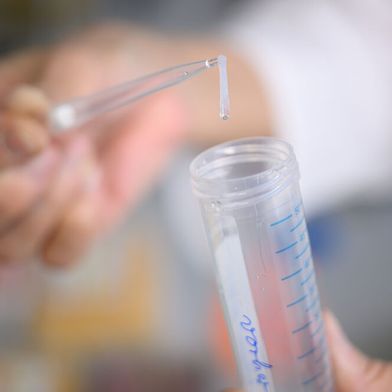 Bei der Genanalyse von 693.869 Menschen europäischer Abstimmung fand das Studienteam die bislang größte Anzahl genetischer Zusammenhänge mit Angstzuständen.  (Bild: © Daniel Peter / UKW)