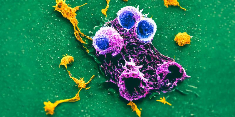 Natürliche Killerzellen des Immunsystems sind in der Lage Tumorzellen oder Krankheitserreger abzutöten. (Symbolbild) Natürliche Killerzellen des Immunsystems sind in der Lage Tumorzellen oder Krankheitserreger abzutöten. (Symbolbild)