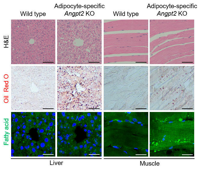 Representative images of morphology and fat accumulation into the liver (left) and muscle (right) in wild type and adipocyte-specific Angpt2 knockout mice. Fat accumulation in adipocyte-specific Angpt2 knockout mice could be observed in white spots (top), red oil staining (middle), and green fatty acid intensity (bottom). (IBS)