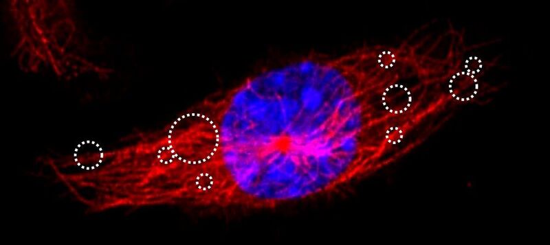 Fluoreszenzmikroskopische Aufnahme einer Makrophage mit blau eingefärbtem Zellkern und rot eingefärbten Mikrotubuli. Diese dienen als „Schienen“, auf denen molekulare Motoren wie zum Beispiel das Dynein die Partikel transportieren.  (Steve Keller )