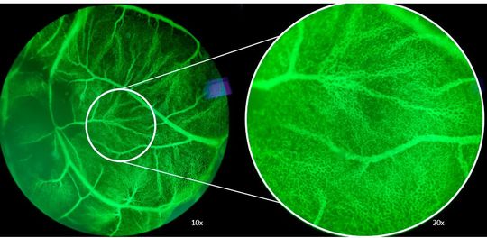 Im Vergleich dazu ein Kontroll-Hühnerei (oben) mit einem dichten Teppich aus feinsten Blutgefässen.(Bild:  Empa)
