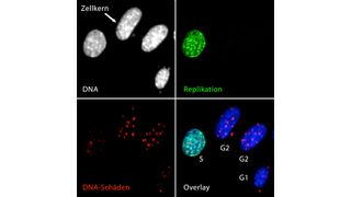 Die fluoreszenzmikroskopischen Bilder von Zellen, in denen das Gen NBS1 inaktiviert wurde, zeigen die DNA im Zellkern, sowie deren Replikation und DNA-Schäden (hiMAC-Analyse). (Bild: Christopher Bruhn / FLI)