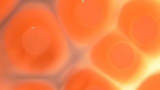 Staphylococcus-aureus-Bakterien auf Nährboden (Bild: Grunert/Vetmeduni Vienna)