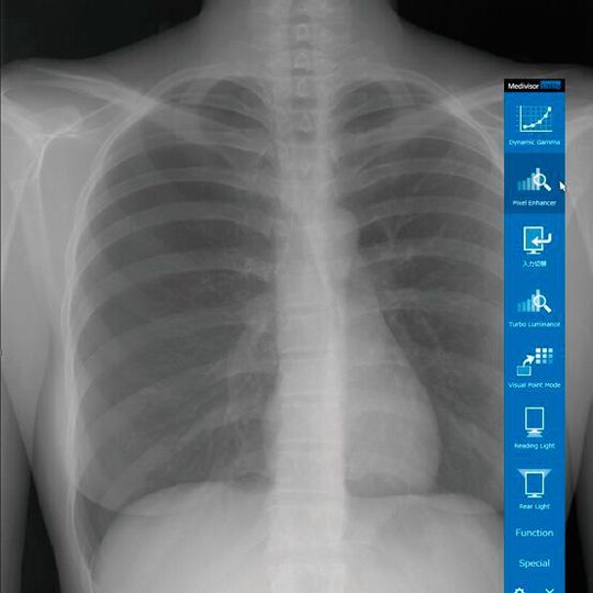 Die Utility Software beschleunigt den Zugriff auf Funktionen im QA Medivisor Agent.(Bild:  JVCKENWOOD)