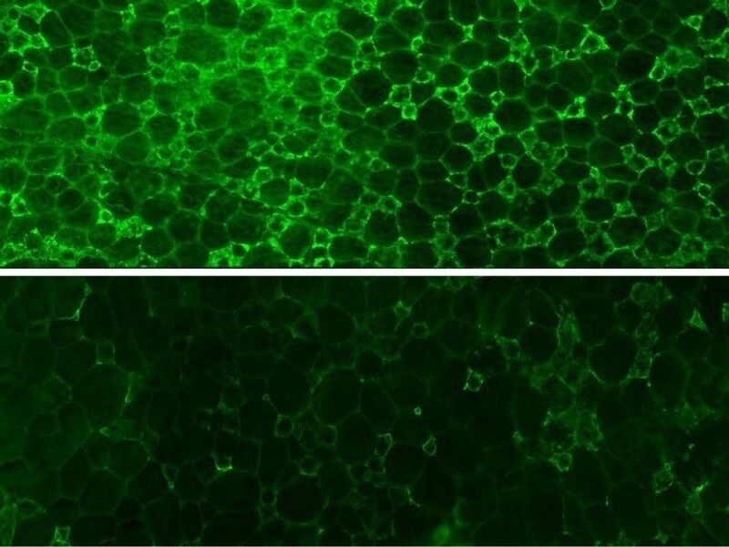 Entzündungsfördernde Makrophagen (grün) überfluten das Fettgewebe stark übergewichtiger Mäuse (oben, Kontrolle). Die Einwanderung löst chronische Entzündungen und Typ-2-Diabetes aus. Wird HO-1 aus Makrophagen entfernt (unten), wird deren Ansammlung im Fettgewebe unterbunden. Das verhindert Stoffwechselerkrankungen. (Bild: MPI f. Immunbiologie und Epigenetik/ A. Pospisilik)