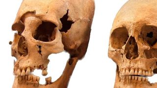 Stark und mittel deformierte Schädel (v.l.) aus den frühmittelalterlichen Fundplätzen Altenerding und Straubing (Ausschnitt) (© Staatssammlung für Anthropologie und Paläoanatomie München)