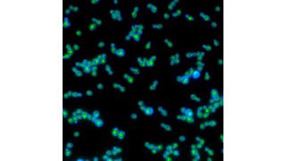 Green rhodopsin proteins inside the blue cell walls help these yeast grow faster when exposed to light. (Source: Anthony Burnetti, Georgia Institute of Technology)
