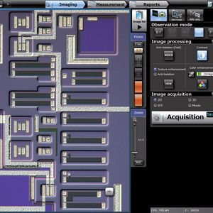 Bedienermodus: Ermöglicht die individuelle Anpassung der Schnittstelle, für Nutzer, die täglich die gleichen Untersuchungen durchführen.