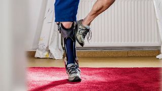 Die Beinorthese C-Brace im Einsatz (Ottobock)