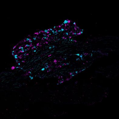 Schnitt durch ein Spinalganglion einer Maus, in dem zwei unterschiedliche Typen von Schmerzrezeptoren in Cyan (türkis) und Magenta (pink) angefärbt sind. (Bild: Sampurna Chakrabarti, Max Delbrück Center)