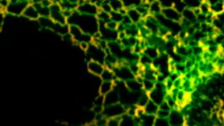 In höheren Zellen verbleiben fehlgefaltete Membranproteine im Endoplasmatischen Retikulum (ER). Das mikroskopische Bild zeigt ein beschädigtes Membranprotein (grün) und ein ER-Protein (rot). Wo beide Proteine gemeinsam vorkommen, ergibt sich eine gelbe Färbung. (Bild: Zentrum für Molekulare Biologie der Universität Heidelberg)