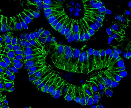 Darm-Organoide: Nach einer Behandlung mit IFN-Y differenzieren die Darmzellen. Die Zellkerne (blau) der Epithelzellen (grün) lokalisieren sich am basalen (äußeren) Rand der Organoide. Damit geht eine verstärkte Produktion des Rezeptors ACE2 einher, den SARS-CoV-2 als Einstiegspforte in die Zellen nutzt. Darm-Organoide: Nach einer Behandlung mit IFN-Y differenzieren die Darmzellen. Die Zellkerne (blau) der Epithelzellen (grün) lokalisieren sich am basalen (äußeren) Rand der Organoide. Damit geht eine verstärkte Produktion des Rezeptors ACE2 einher, den SARS-CoV-2 als Einstiegspforte in die Zellen nutzt.