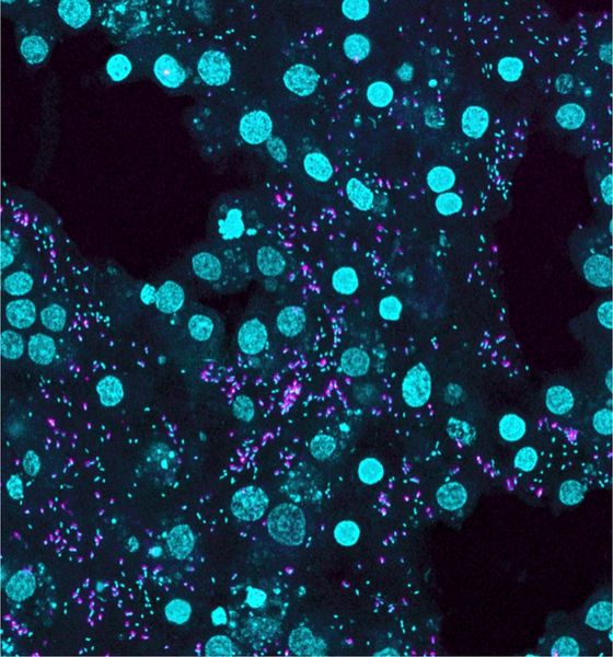 Archaeen als „Flexitarier“ Symbiotische Ammoniak-oxidierende Archaeen in Meeresschwämmen sind keine strikten Spezialisten, sondern eher Flexitarier: Ein Team um die Mikrobiologinnen Bettina Glasl und Katharina Kitzinger von der Universität Wien hat mit Partnern aus Australien gezeigt, dass diese Mikroben neben Ammoniak auch Aminosäuren wie Valin, Leucin und Isoleucin nutzen – und so vermutlich mit ihrem tierischen Wirt kommunizieren.   Die Befunde rücken eine der ältesten Tier-Mikroben-Symbiosen der Erde in neues Licht und deuten auf eine bislang unterschätzte Rolle der Archaeen hin.   Die Fluoreszenzmikroskop-Aufnahme oben zeigt in 1.000-facher Vergrößerung das Erbgut des Schwamms und der Mikroben (beide in Blau) sowie die symbiotischen Ammoniak-oxidierenden Archaeen (in Pink).    Hier geht‘s zur Originalmeldung Wissenschaftsbild des Tages vom 15.9.2026  (Bild: Bettina Glasl)