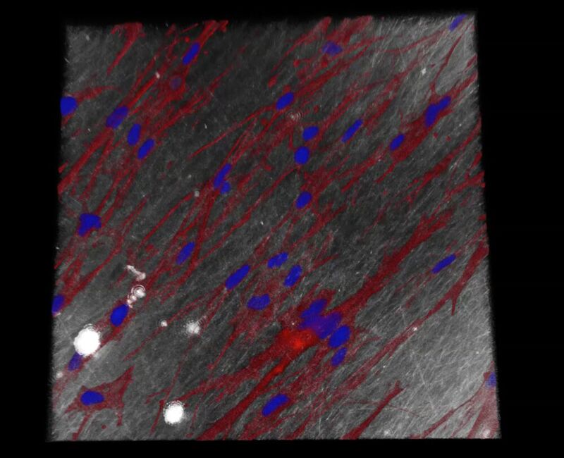 Fibroblasten (Bindegewebszellen) auf der elektroversponnenen Renacer-Membran unter dem Konfokalmikroskop (rot: Zytoskelett der Zellen, blau: Zellkerne) .